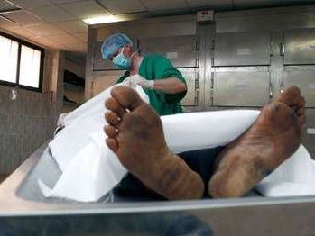 Бакинский врач жалуется на нехватку трупов, с которых можно сдирать кожу