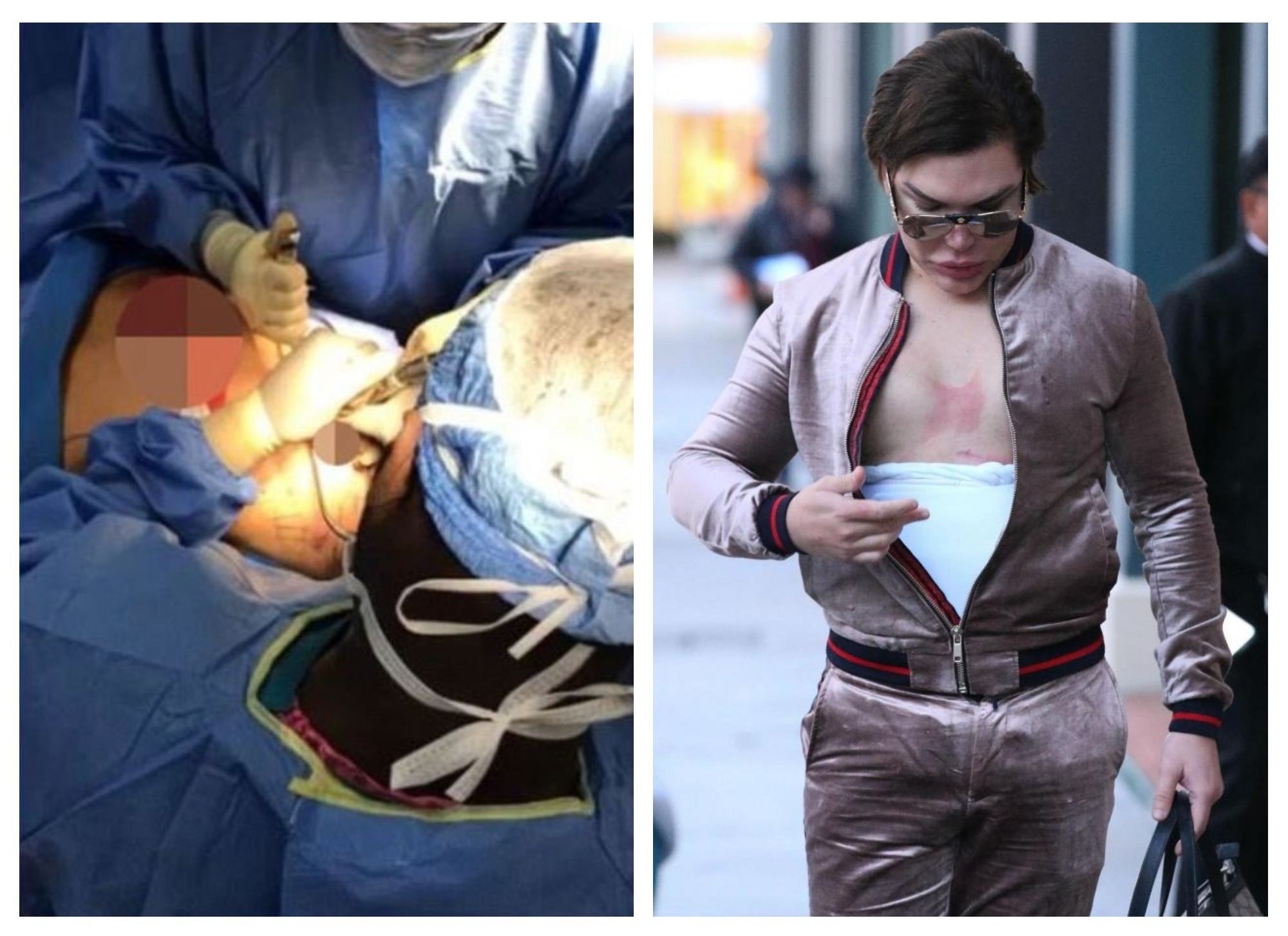 ����: 1news.az