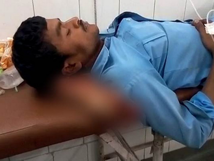 Пациенту индийской больницы подложили вместо подушки его отрезанную ногу - ФОТО - ВИДЕО