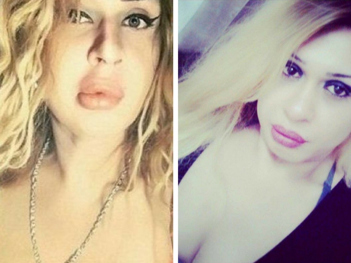 Жестоко убит азербайджанский транссексуал «Кристина» - ФОТО – ВИДЕО