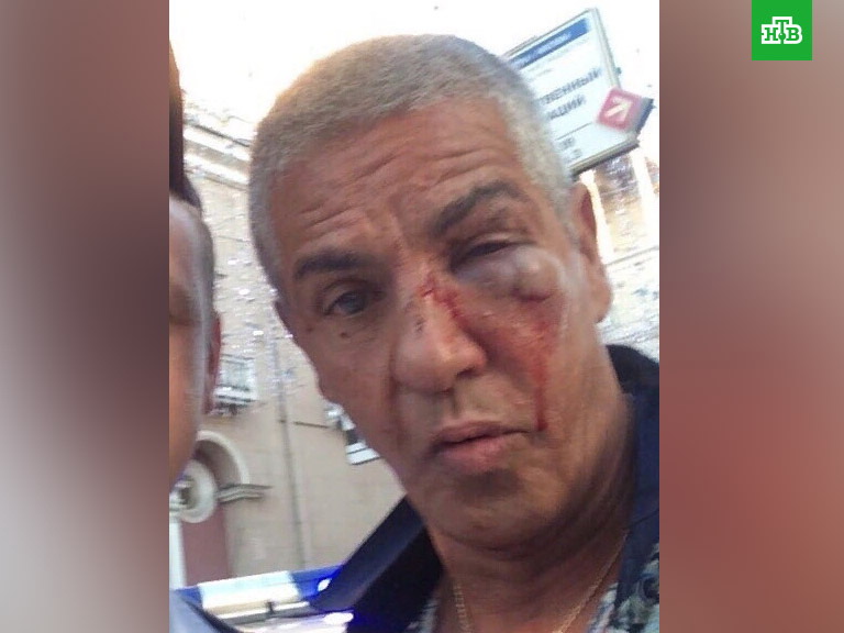 Звезда фильма «Такси» Сэми Насери подробно рассказал, как его избивали в Москве - ФОТО