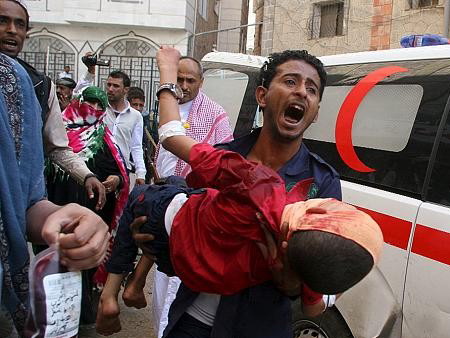 В Йемене погибло 30 детей в результате обстрела школьного автобуса