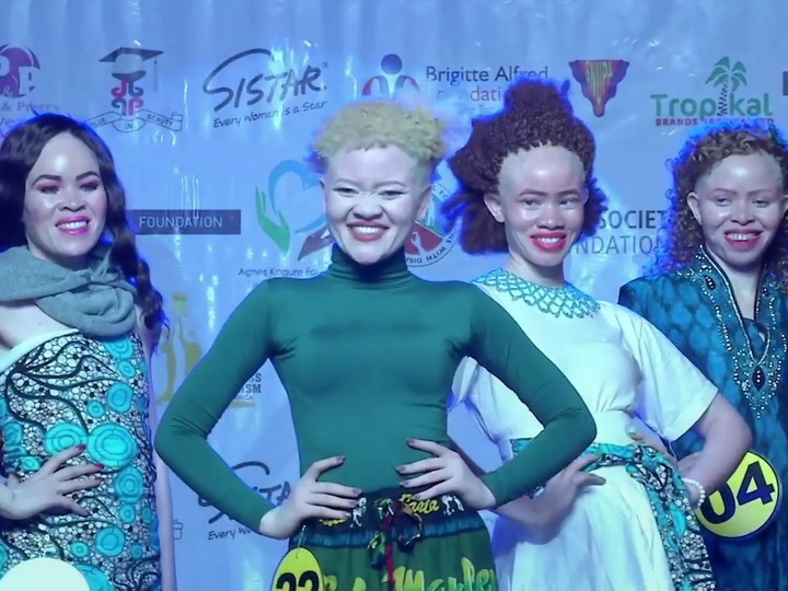 В Африке прошел конкурс красоты среди альбиносов – ВИДЕО