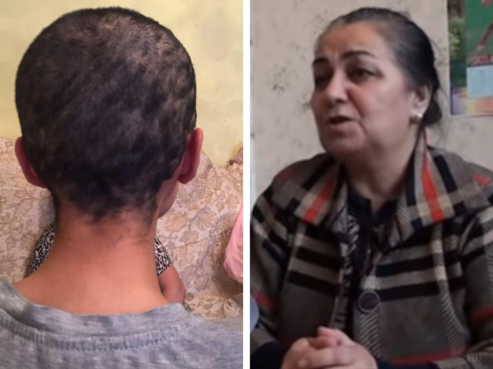 Мать женщины, которой обрили голову: «Когда мой муж узнал о том, что сделали с дочкой, у него случился инфаркт» - ФОТО – ВИДЕО