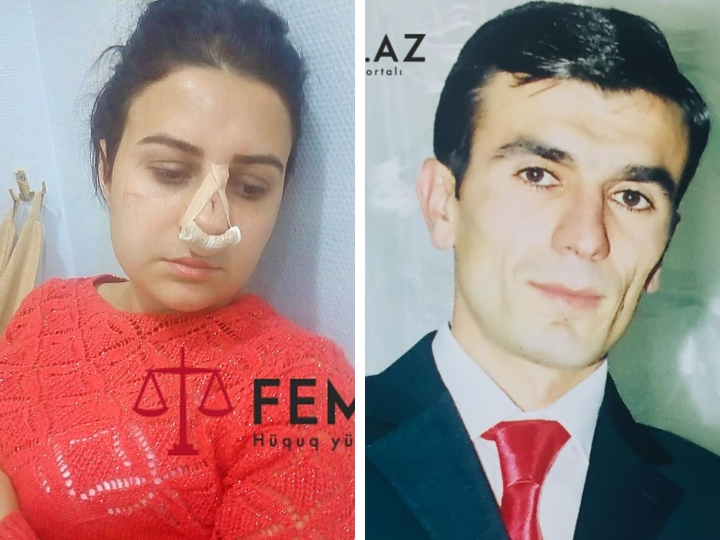 «Напал посреди улицы и сломал мне нос»: В Баку женщина обвиняет бывшего мужа в избиении и преследовании – ФОТО