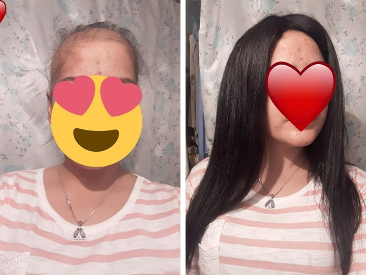 «Saçım saçın olsun»: Азербайджанские женщины жертвуют своими волосами для больных онкологией – ФОТО