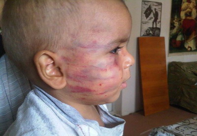 В Баку жестоко избит ребенок – ФОТО