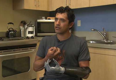 Американский шеф-повар, потерявший руку, получил взамен бионическую, которая «знает» 25 движений - ВИДЕО