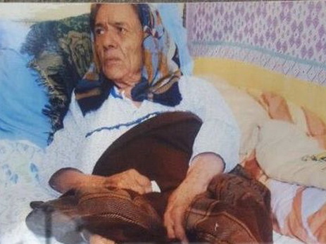 В Баку скончалась женщина, которой хирург по ошибке ампутировал ногу – ФОТО