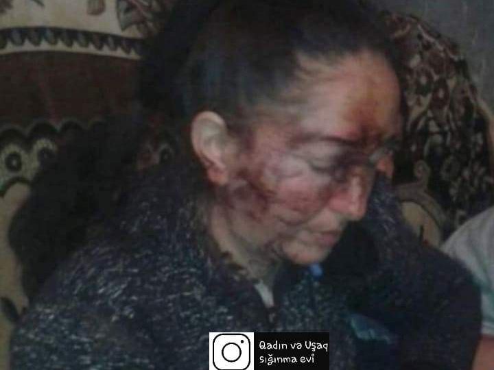 В Азербайджане муж жестоко избил жену – ФОТО