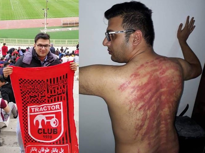 СМИ: В Иране к азербайджанцам, задержанным за протесты против провокационного селфи Пашиняна, применяются пытки – ФОТО - ВИДЕО