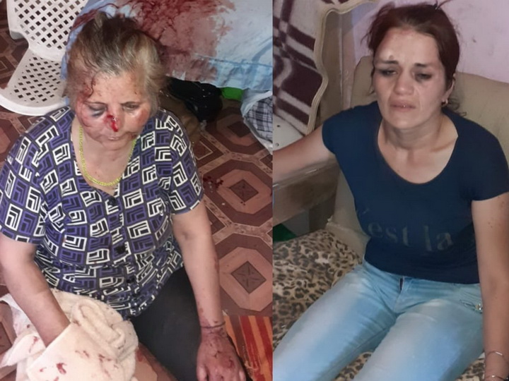 Арестован мужчина, зверски избивший в Баку жену и тещу – ФОТО - ОБНОВЛЕНО