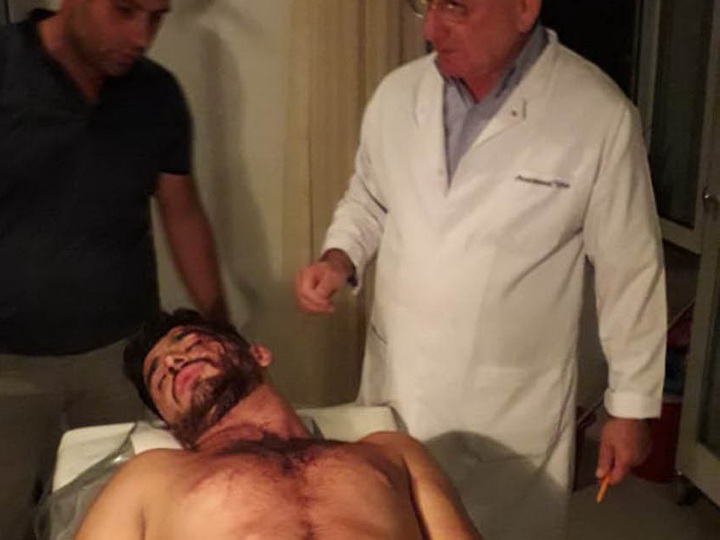 В Кюрдемире произошла массовая драка, есть пострадавшие - ФОТО