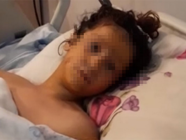 «Азеришыг» о девочке, которую ударило током во время игры в прятки - ФОТО