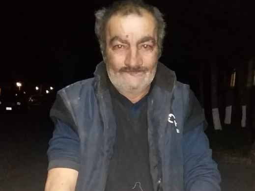Пострадавший от нападения «волка» житель Баку: «Задушил и сжег» – ФОТО - ВИДЕО