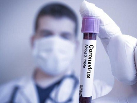 TƏBİB: Virus aramızdadır, çox təmas daha çox yoluxmaya səbəb ola bilər