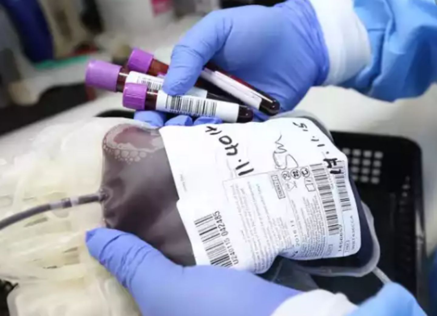 В Азербайджане больных коронавирусом начали лечить плазмой крови выздоровевших