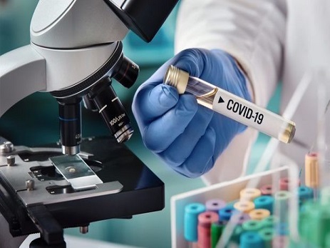 Bu günün statistikası: daha 106 nəfərdə koronavirus aşkarlanıb, 59 nəfər sağalıb