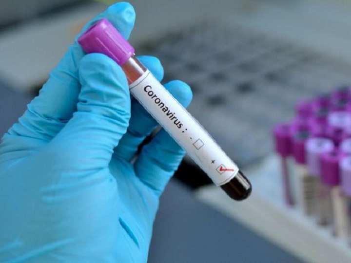 Gizli yas mərasimində 163 nəfər koronavirusa yoluxdu