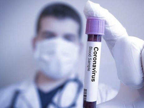 Azərbaycanda koronovirusa yoluxmada azalma müşahidə olunub: 493 nəfər yoluxub, 561 nəfər sağalıb