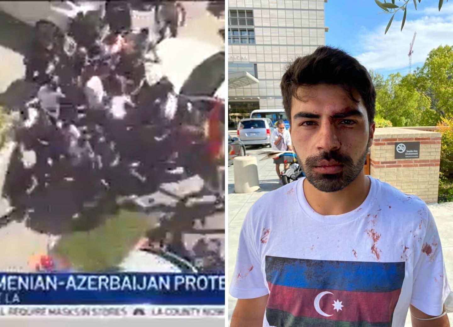 Провокация в Лос-Анджелесе: тысячи агрессивно настроенных армян напали на азербайджанцев, есть пострадавшие - ФОТО - ВИДЕО