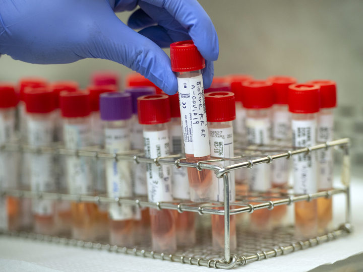 Koronavirus Azərbaycanda: 133 yeni yoluxan, 2 ölən, 86 sağalan var - RƏSMİ