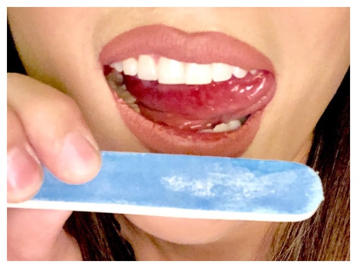 Новый опасный тренд в TikTok: Выравнивание зубов с помощью пилки для ногтей – ВИДЕО