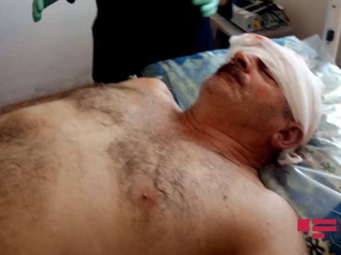 В результате армянского артобстрела ранен житель азербайджанского села