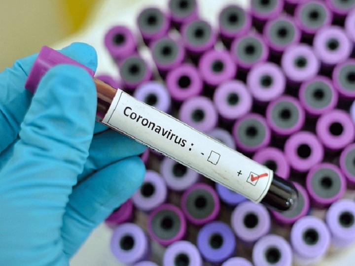 Ermənistanda daha 2314 nəfər koronavirusa yoluxdu