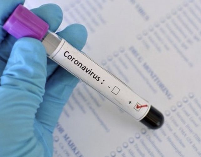 Bakıda koronavirusa ən çox yoluxma bu rayondadır