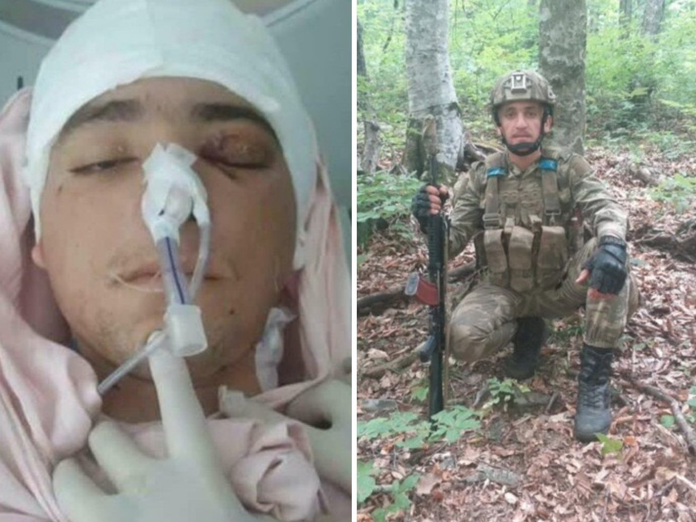 Раненый во время боевых действий в Карабахе военнослужащий очнулся спустя два дня в морге