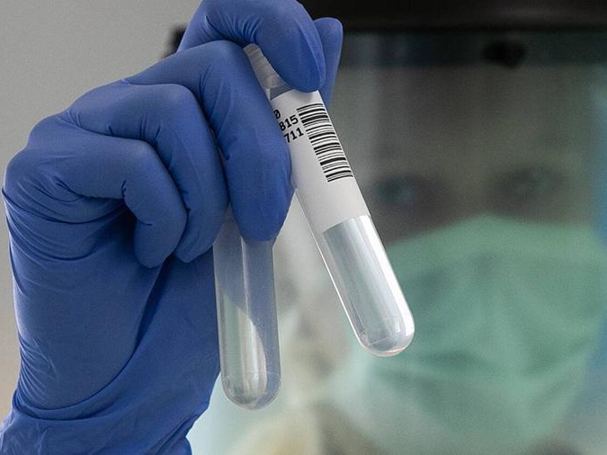 Эксперты ВОЗ прибыли в Ухань для расследования происхождения коронавируса