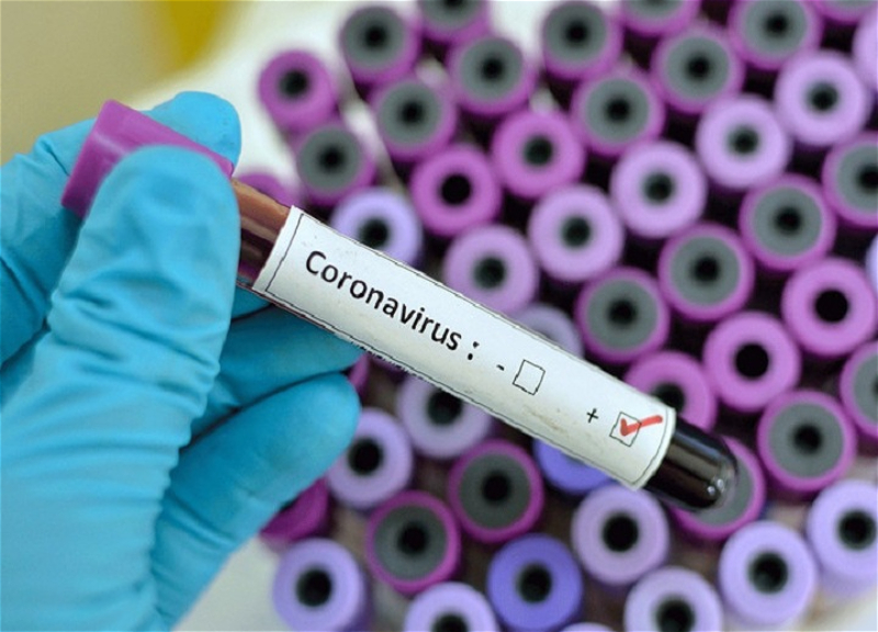 Azərbaycanda koronavirusun yeni ştammı aşkarlandı