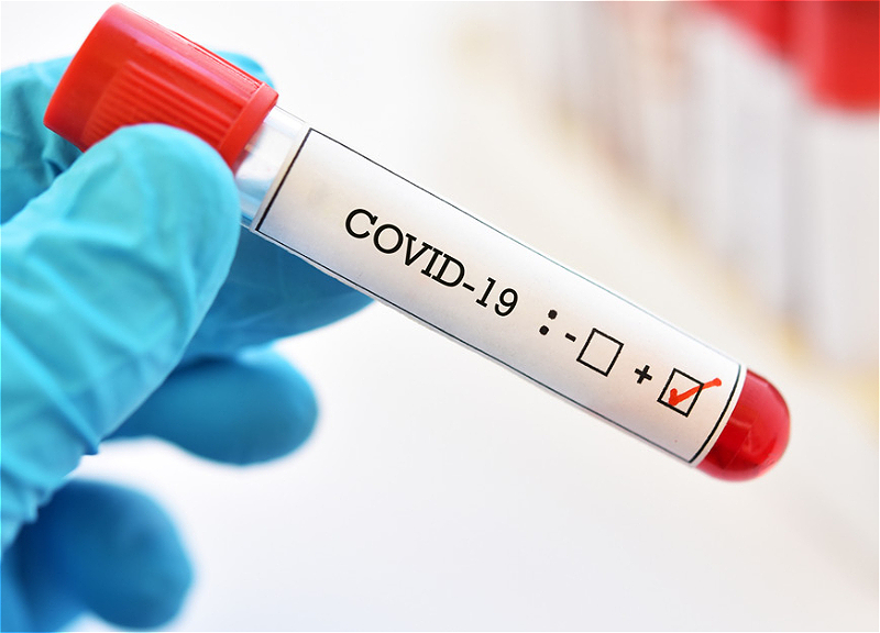 Статистика на 13 мая: В Азербайджане число излечившихся от коронавируса почти втрое превысило число заболевших