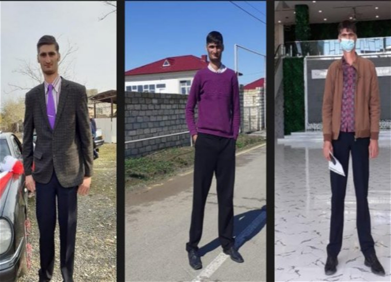 Самый высокий человек в Азербайджане: «Мой рост мешает мне жениться» - ФОТО