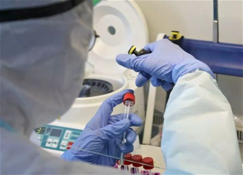 Bu gün 95 nəfər koronavirusa yoluxub, ölən yoxdur