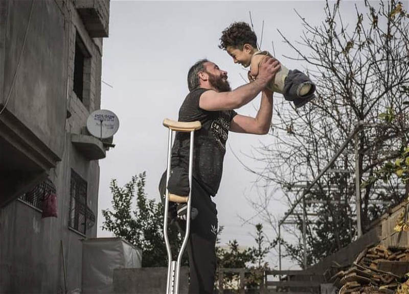 Работа турецкого фотографа об ужасах войны в Сирии стала лучшей на международном конкурсе - ФОТО