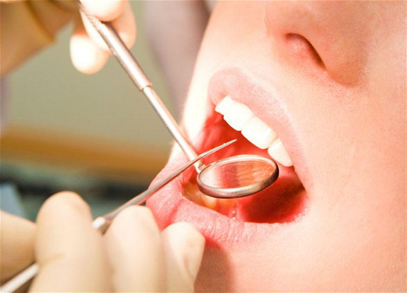 Diş əti xəstəlikləri COVID-19-un fəsadlarının ağırlaşmasına səbəb ola bilər? - Həkimdən CAVAB
