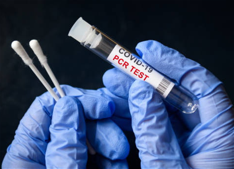 В Азербайджане начато производство ПЦР-тестов на коронавирус - ВИДЕО