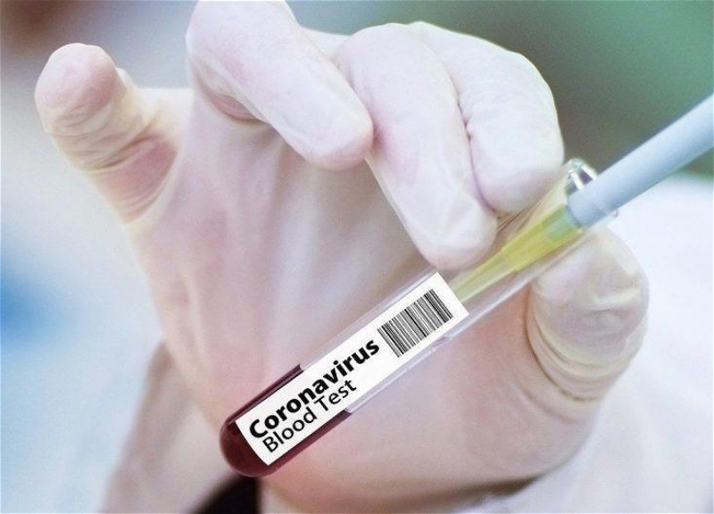 В Азербайджане выявлены еще 1 186 случаев заражения коронавирусом
