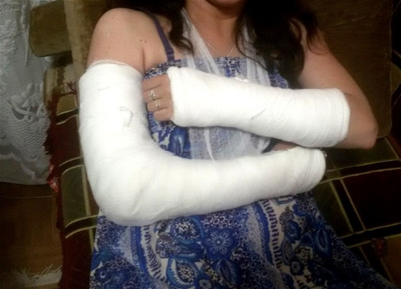 В Баку у девушки сломаны обе руки в результате избиения женихом