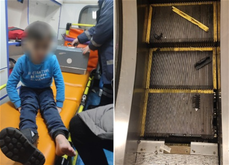 В Баку спасли ребенка, у которого застряла нога в эскалаторе – ФОТО - ВИДЕО