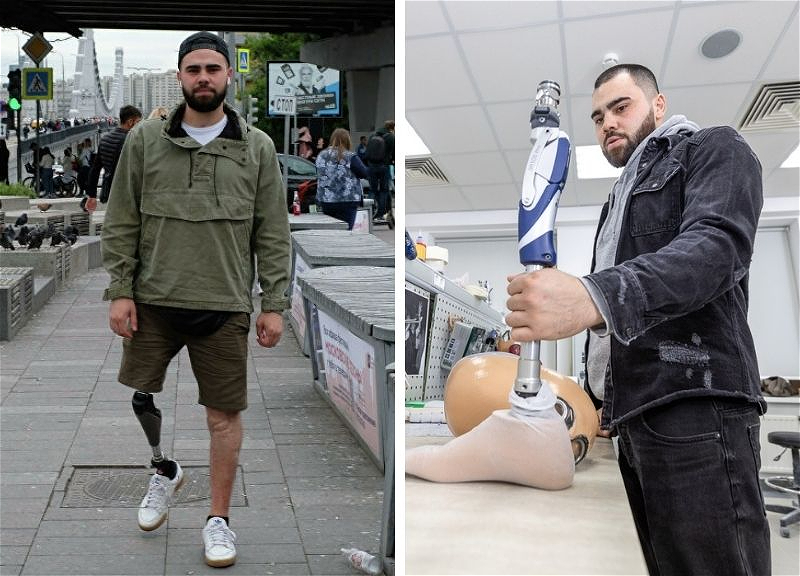 Потерял ногу в теракте и стал протезистом. Пронзительная история Ибрагима из Ставрополя – ФОТО – ВИДЕО