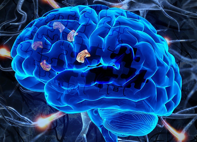 У переболевших COVID-19 нашли изменения в мозгу как при болезни Альцгеймера