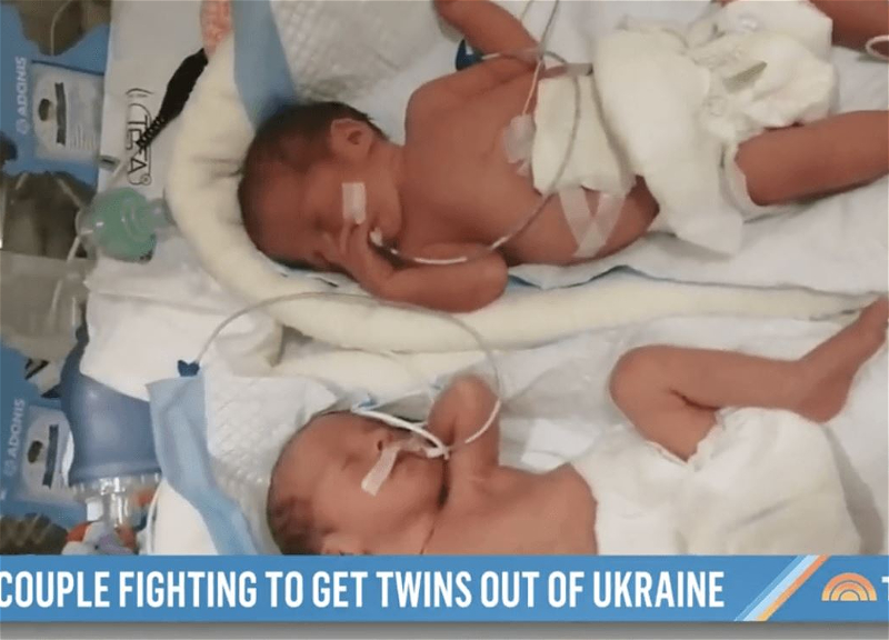 До слез: история недоношенных близнецов, родившихся в Украине в начале войны - ВИДЕО