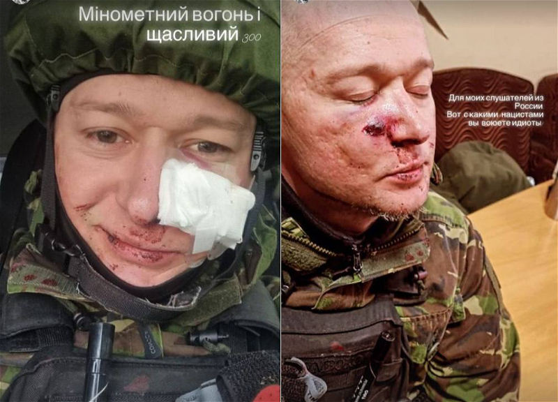 В Украине ранен лидер группы «Бумбокс» – ФОТО
