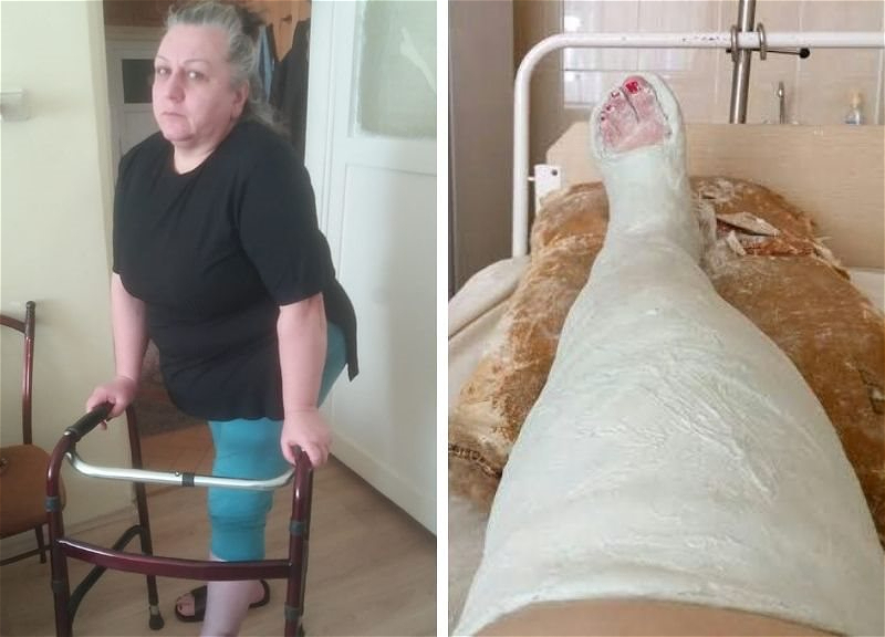 ПРИЗЫВ О ПОМОЩИ. Тамилла Салимова: «Если не сделать операцию, мне могут ампутировать ногу…» – ФОТО