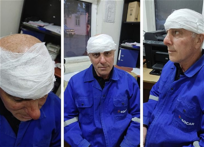 МВД прокомментировало факт избиения сотрудника «Азеригаз»