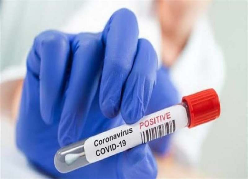 Bu gün 10 nəfər koronavirusa yoluxub, ölən olmayıb – STATİSTİKA