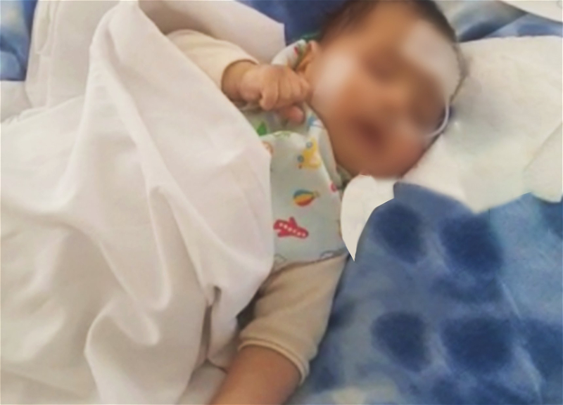 В Баку спасли трехмесячного малыша, неделю находившегося в коме - ФОТО